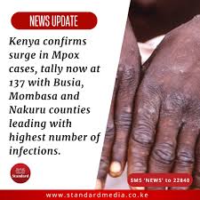 Mombasa: Wzrost i Wyzwania Portu Morskiego w Kenii