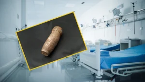 Pacjent z pociskiem artyleryjskim w Francji – raport